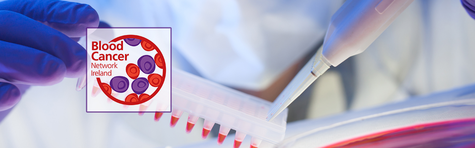 Blood sample being prepared for testing